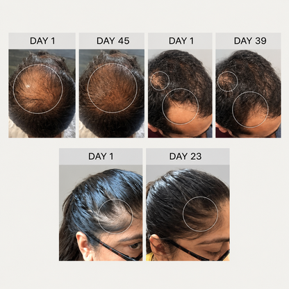 Root Renewal™  For Thinning, Shedding, & Lose of  Hair