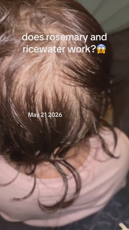 Root Renewal™  For Thinning, Shedding, & Lose of  Hair